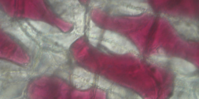 Enkelt osmosförsök med rödlök och epitelceller