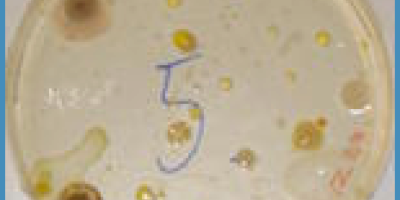 Nyckelbegrepp i mikrobiologi till kursen i Bioteknik