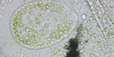 Paramecium bursaria äter