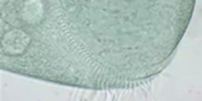 Ciliaten Stentor
