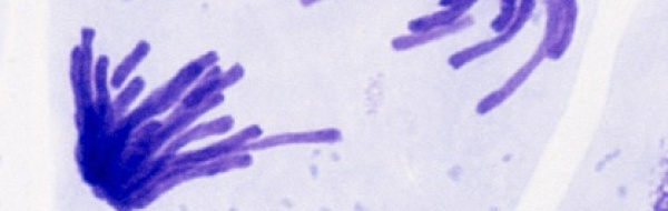 Prov 2016-10-27 i Cellbiologi, Cellens genetik och Klassisk genetik