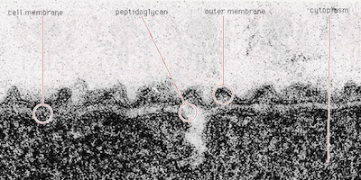 Prov 2008-10-16 i Bakteriologi och mikrobiologins historia