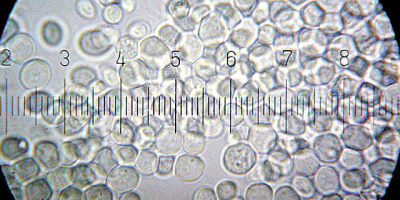 Jäst är en viktig eukaryot värd för rekombinant DNA