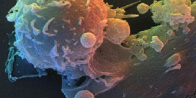 Årets Nobelpris i Fysiologi/Medicin 2011