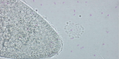 Paramecium caudatum