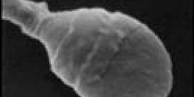 Homunculus