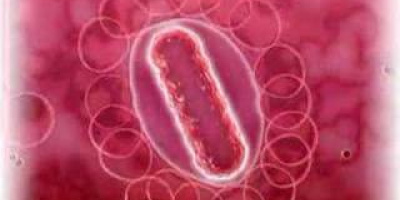 Hur smittar Legionella?