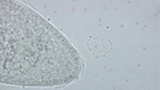 Paramecium caudatum