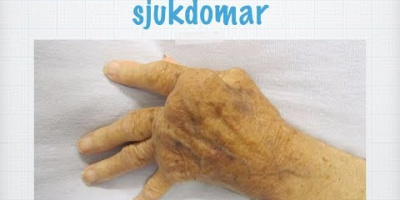 Immunologiska sjukdomar