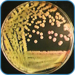 Mikrobiologi