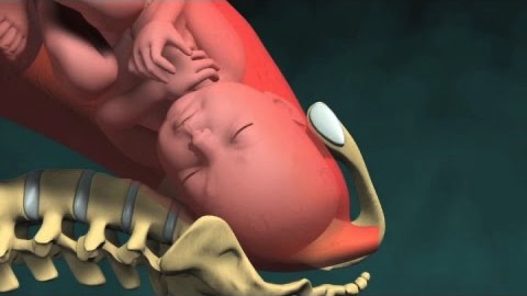 3D-animering av förlossning