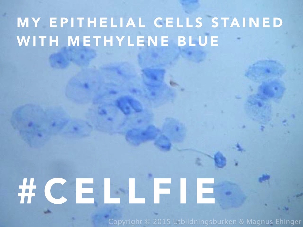 Mina epitelceller färgade med metylenblått: En cellfie.