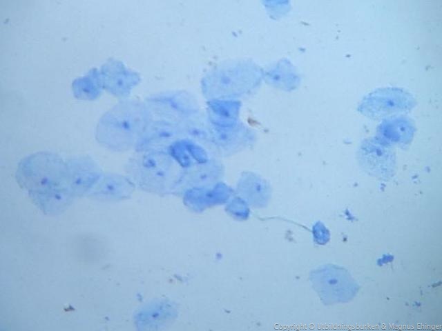 epitelceller metylenblaa 03 detalj