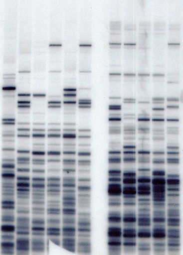 Restultatet av en DNA-fingerprinting-analys. 
