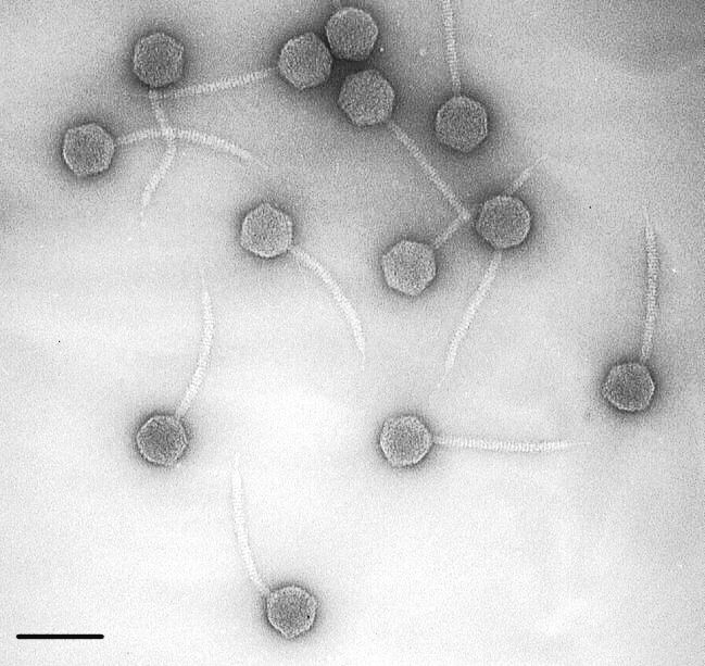 Elektronmikroskopbild av bakteriofag λ. 